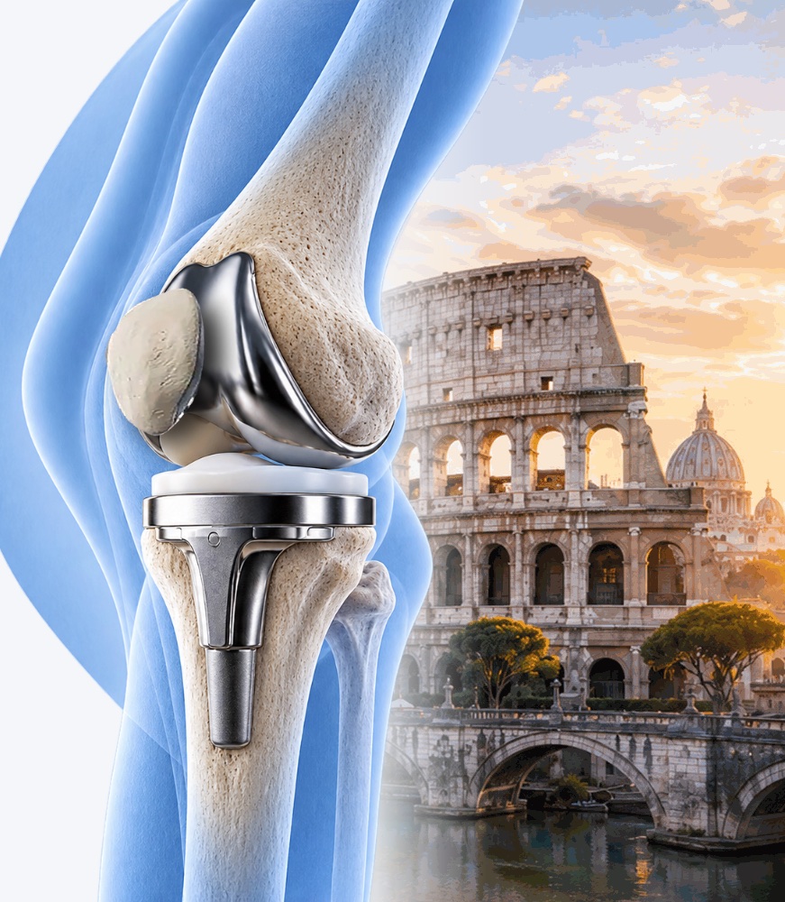 A total knee replacement beside the Colosseum and St Peter&rsquo;s Basilica, Rome